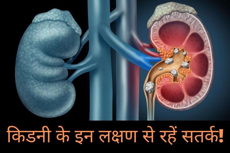 Kidney Problem : कहीं आपको भी किडनी की परेशानी तो नहीं? बॉडी में दिखते हैं ये 5 लक्षण तो हो जाएं सतर्क!