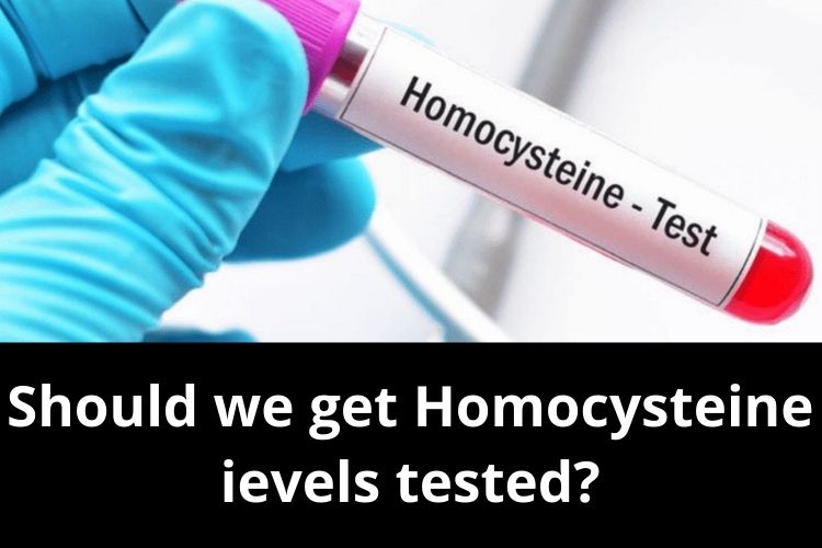 What are High homocysteine levels? Do we need to worry about it? 