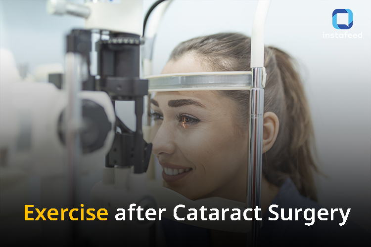 Exercise After Cataract Surgery: Stay Safe, Stay Active