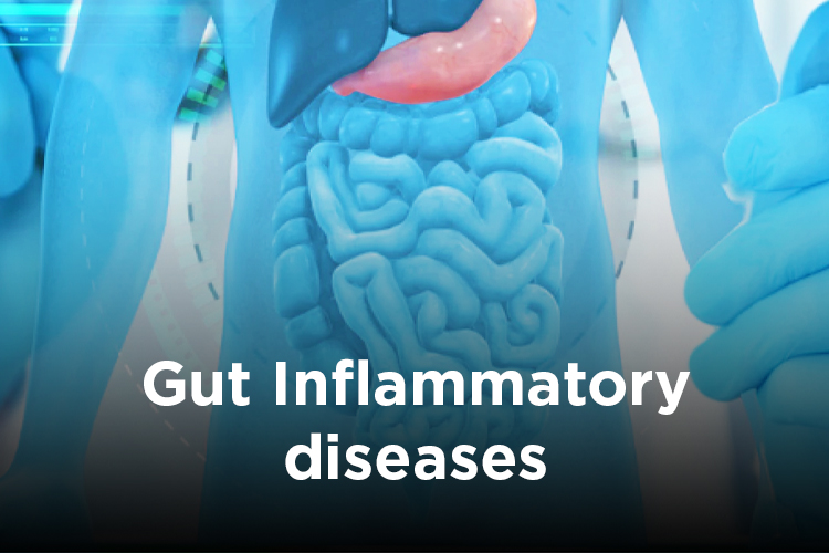 Sugar and Gut inflammatory diseases