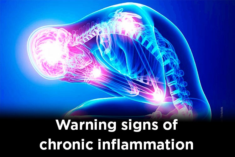 7 symptoms of chronic inflammation in your body. Our body gives warning signs from before.