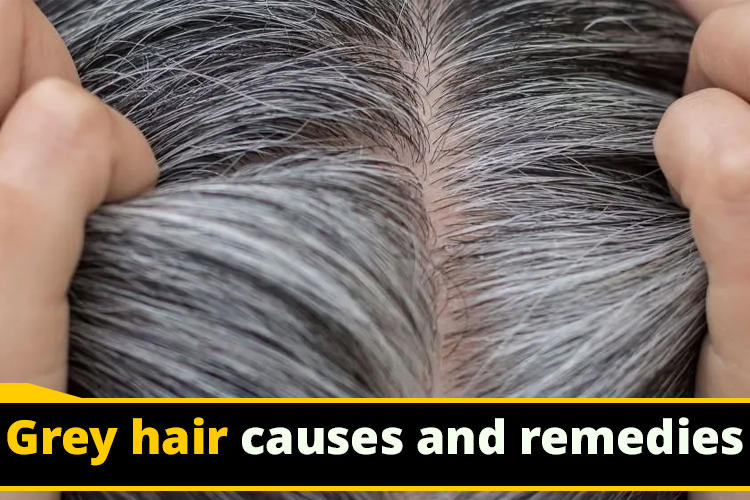 Grey Hair Problems: Hair turning white before age? These indigenous things also help