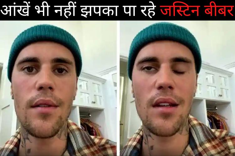 Justin Bieber paralysis: जानिए कौन सी बीमारी ने जकड़ा जस्टिन बीबर को, इस गंभीर बीमारी के लक्षणों को ना करें अनदेखा