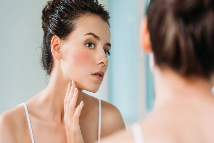 Do you have Sensitive Skin? Here's how to choose the best Moisturiser 