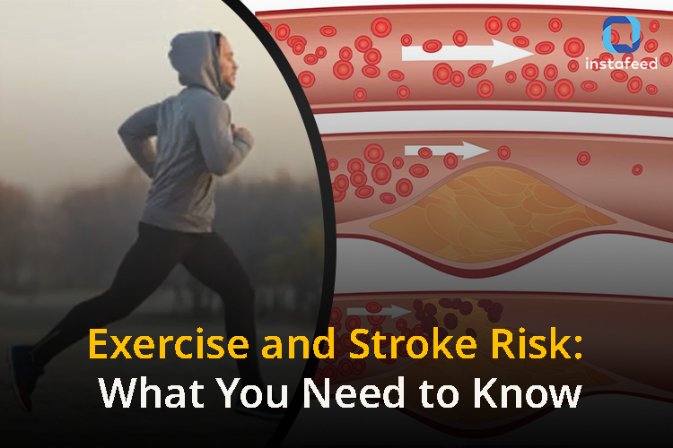 Exercise and Blocked Arteries: Understanding the Potential Stroke Risk