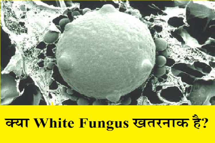 ब्लैक फंगस से भी खतरनाक है White Fungus? इसने देश में हलचल मचा दी है