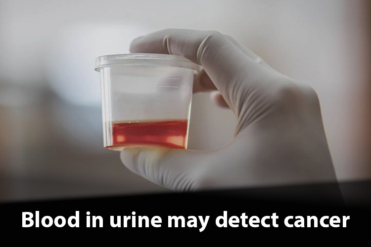 What is the cause behind the occurrence of blood in urine? Is it cancer or something else?