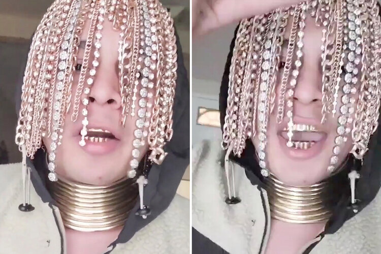 'I wanted to do something different', says Mexican Rapper, gets chain hooks implanted in scalp 