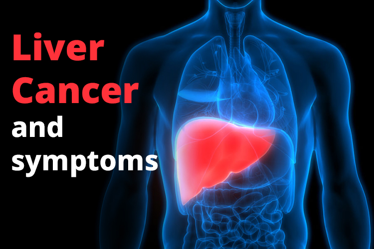 Alcohol Abuse and Liver cancer