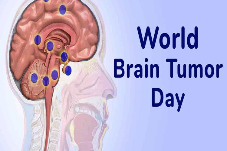  World Brain Tumour Day 2021: तेज सिरदर्द हो सकता है ब्रेन ट्यूमर का संकेत, जानिए इसके लक्ष्ण