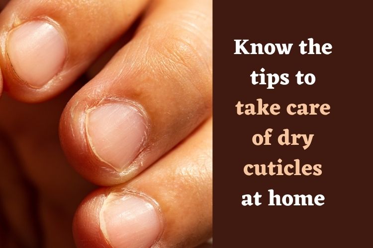 Pamper your Nail Cuticles, Clear out Peeling Issues with Simple Remedies 