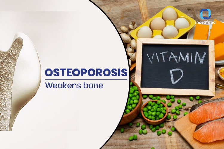 Understanding the Benefits of Vitamin D for Osteoporosis