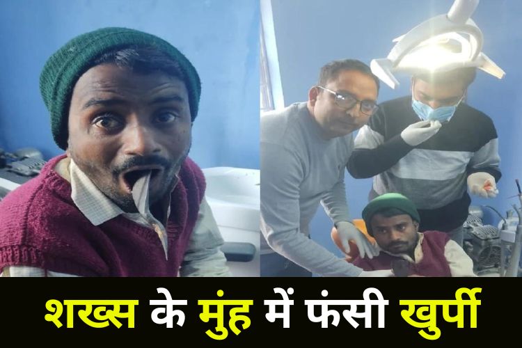 युवक के मुंह में फंसी खुर्पी, डॉक्टर ने किया ऑपरेशन 