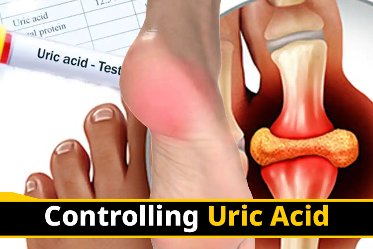 If you want to get rid of uric acid, keep distance from these things, you will see the result immediately quit