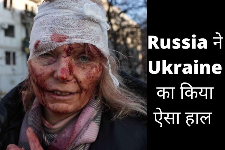 Russia Ukraine Conflict : यूक्रेन पर हुए हमले की  बेहद दर्दनाक तस्वीरें आई सामने, देखें!