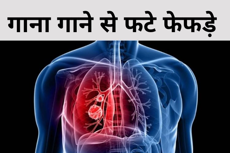 शख्स ने गाया ऐसा गाना कि फट गए फेफड़े, डॉक्टर भी हुए हैरान